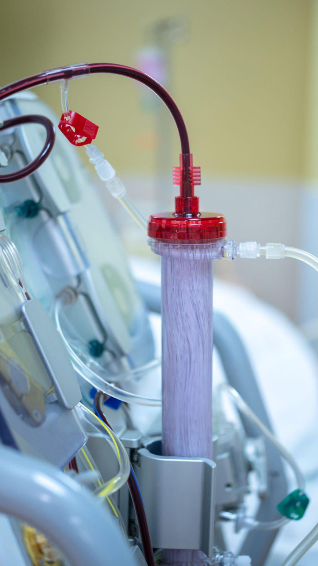 Advin Health Care - Global Leader in Dialysis Product Manufacturing ...